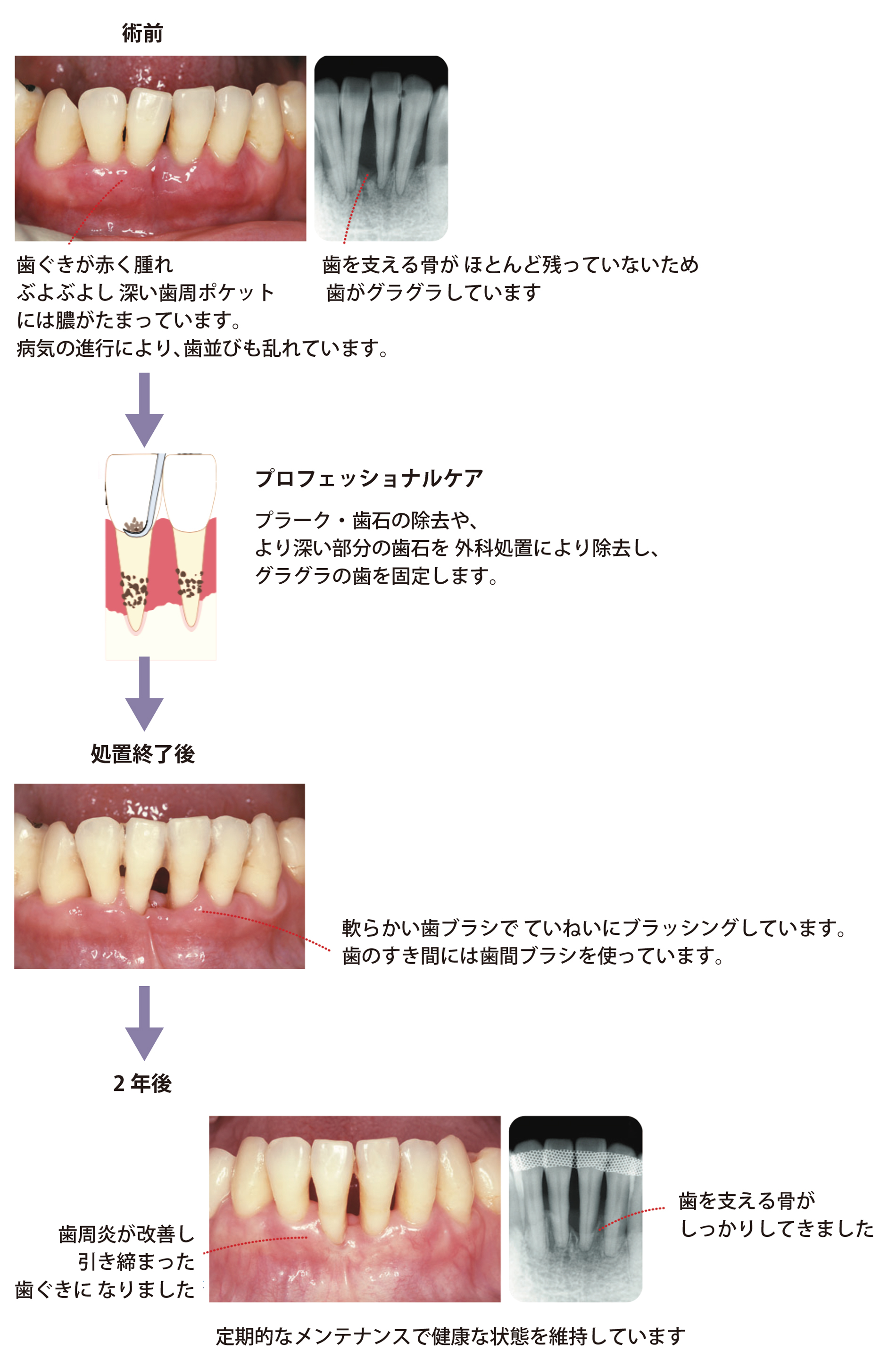 歯周病を治す 一般歯科 | タスクデンタルクリニック